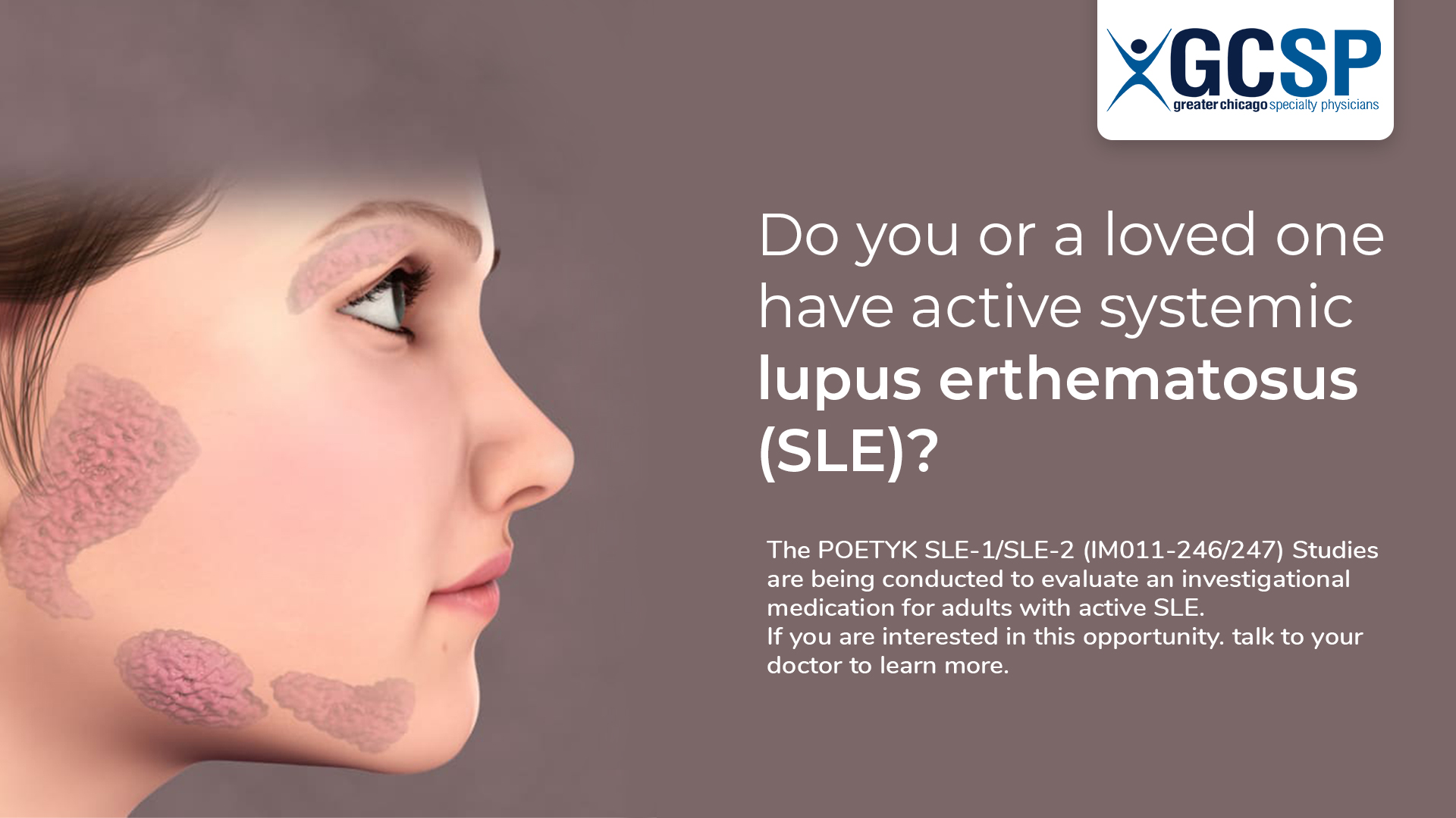 Lupus-Clinical-Trials Lupus-Clinical-Trials