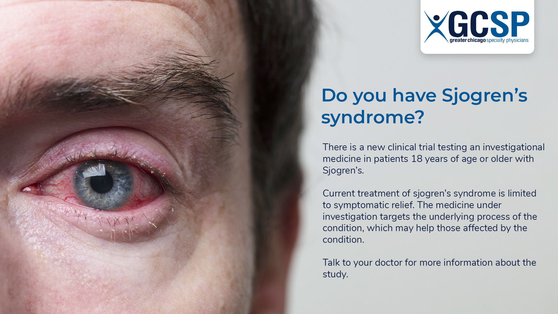 sjogren-syndrome-Clinical-Trial sjogren-syndrome-Clinical-Trial